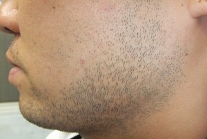 ヒゲ　川口さいたま